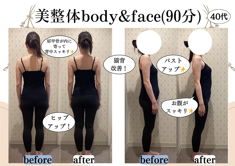 施術事例