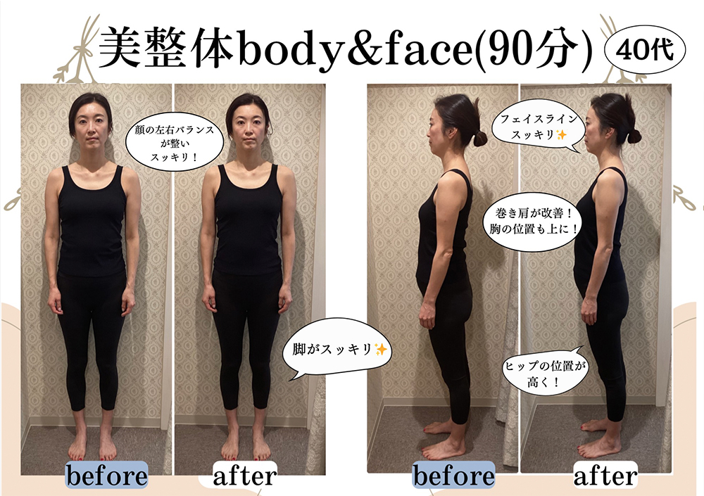 施術事例