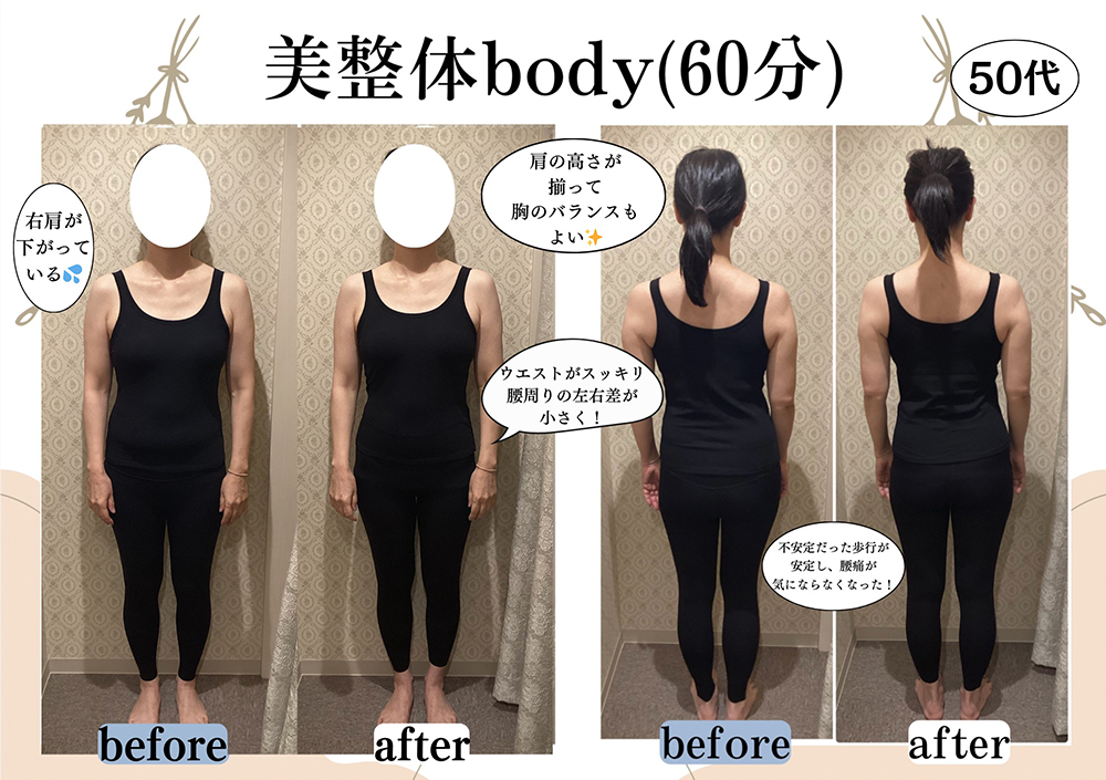 施術事例