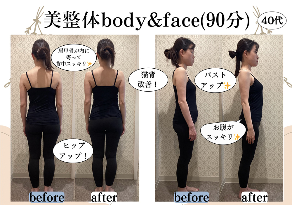 施術事例